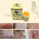 Herbal treatment for psoriasis and eczema
