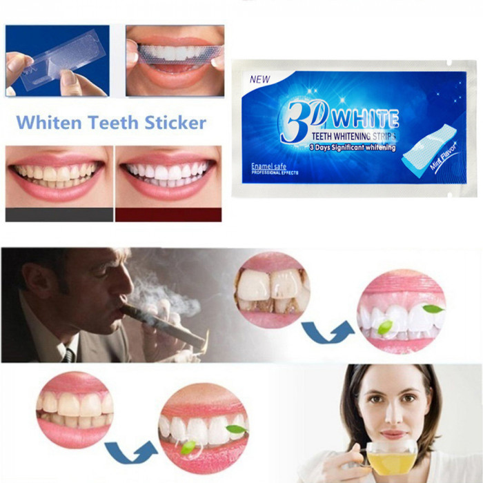 Bandes de blanchiment des dents - Gel de blanchiment dentaire