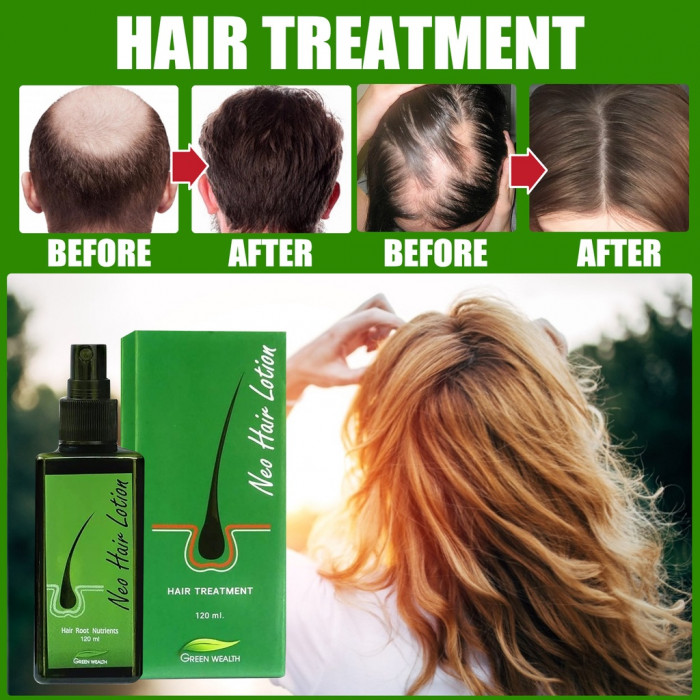 ABOUT NEO HAIR LOTION - NEO HAIR LOTION GREENWEALTH ORIGINAL GENUINE  WHOLESALE MADE IN BANGKOK THAILAND