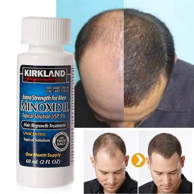 KIRKLAND Signature Minoxidil 5% Topical Solution Extra Strength Hair Regrowth Treatment For Men - KOFshop.com | Online Shopping for Watches, NAVIFORCE Watches, Airpods, Earbuds, Electronics More in Ghana